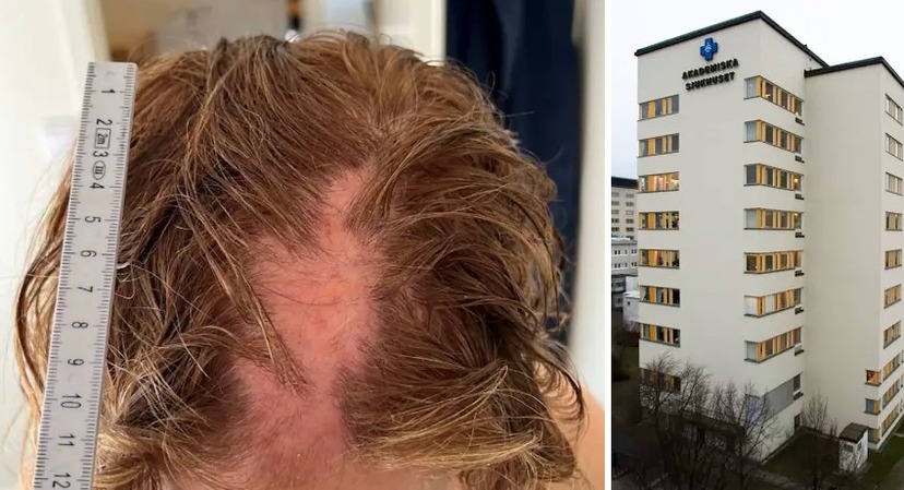 Švédsko: Afghánec brutálně zbil lékařku a vytrhal jí vlasy, zůstává na svobodě