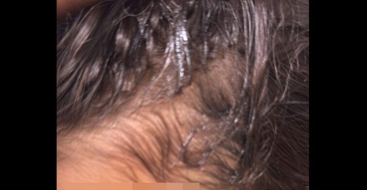 Itálie: Islámské šaría hlídky zaútočily na ženy, protože neměly hidžáb, 12letou dívku polily kyselinou4.9 (37)