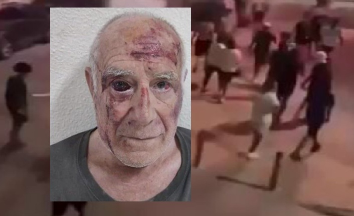 Případ zbitého španělského důchodce: Pachatelé jsou stále svobodě, zatímco vláda se zaměřila na občany, kteří žádají spravedlnost (video) – AKTUALIZACE4.8 (19)