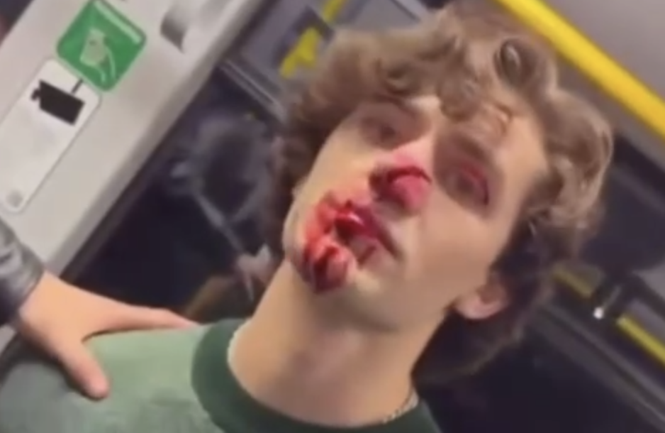 Drážďany: Mladík bránil dívky před obtížnými Syřany, ti ho napadli nožem5 (25)