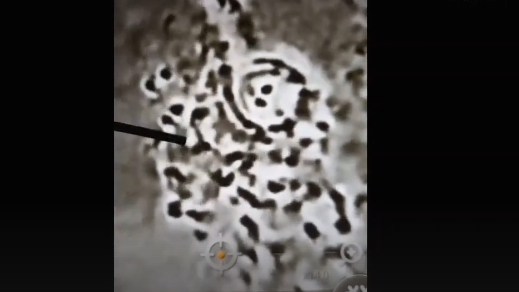 Doktor prozradil, co našel v krvi 33letého „očkovaného“ pacienta (video)5 (22)