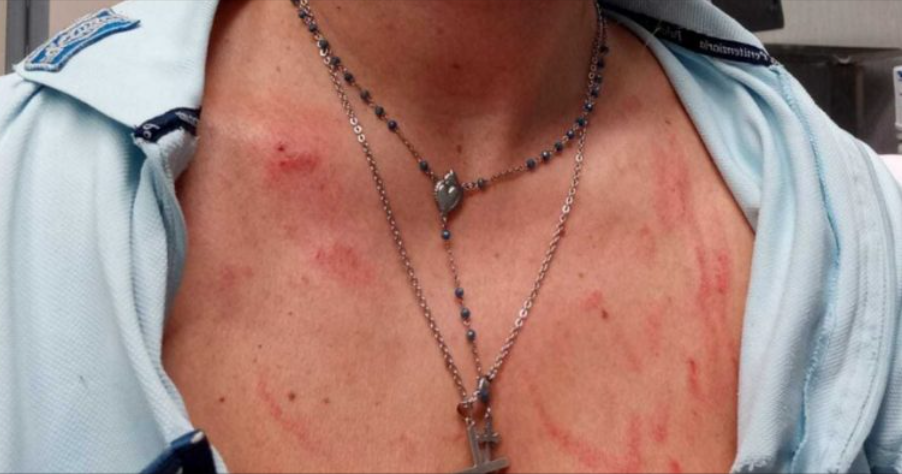 Itálie: Mohamed napadl vězeňskou inspektorku; z krku jí strhl křížek, zbil ji a osahával4.8 (17)